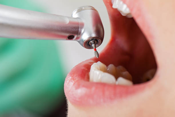 Best Urgent Dental Care for Toothaches in Belle Haven, VA